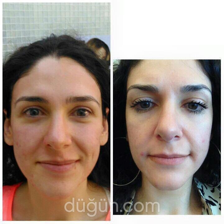 Derma Center Güzellik Merkezi