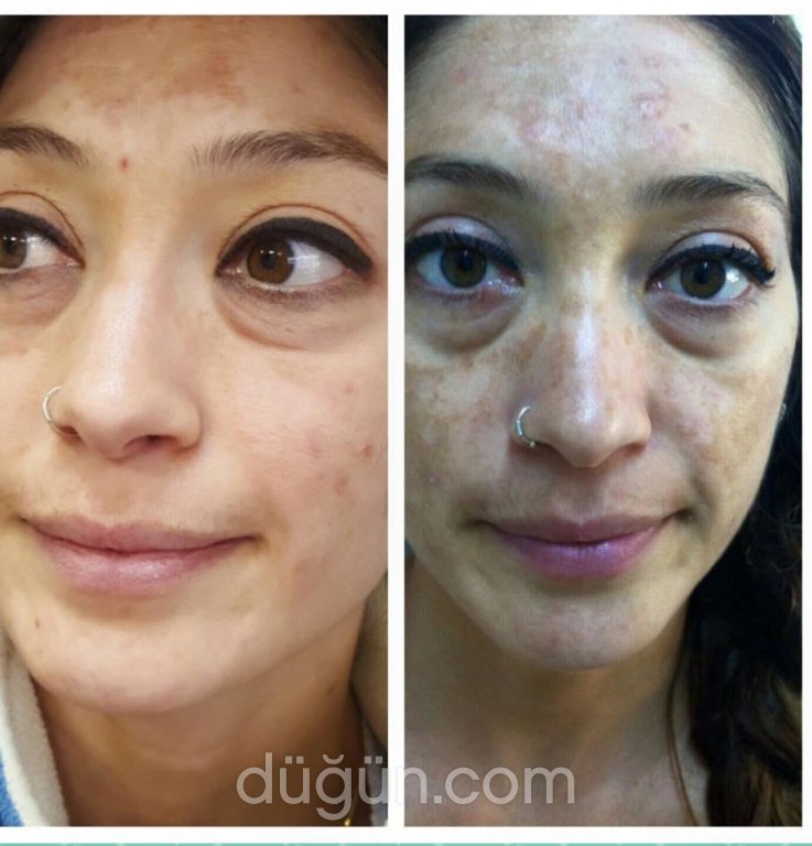 Derma Center Güzellik Merkezi
