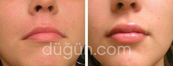 Arion Estetik Kliniği Fahri Kayahan Şubesi