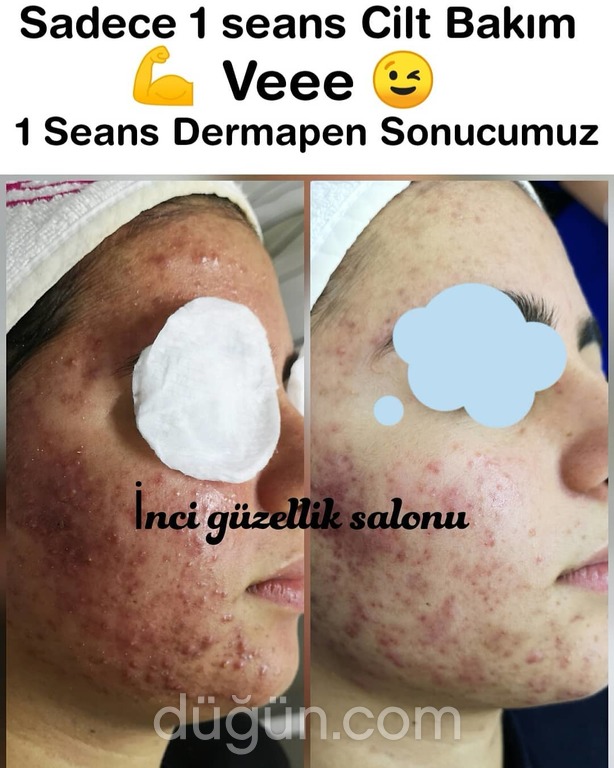 İnci Güzellik Salonu