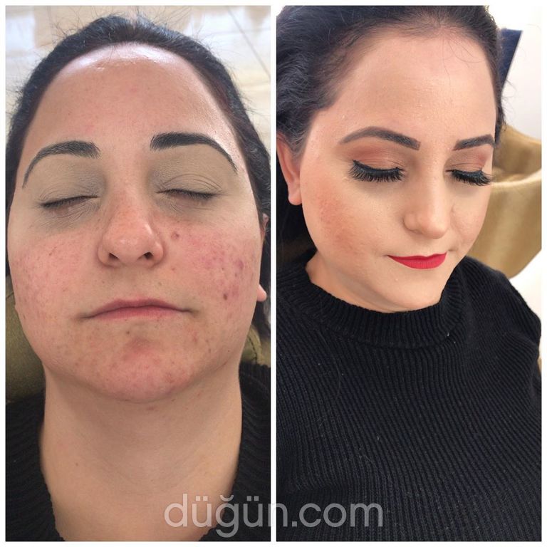 Rahile Akbaş Beauty Center