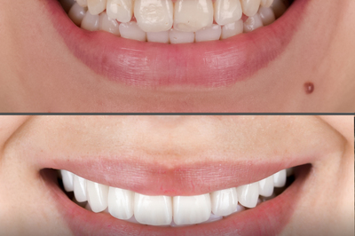 Smilegroup Ağız ve Diş Sağlığı Kliniği