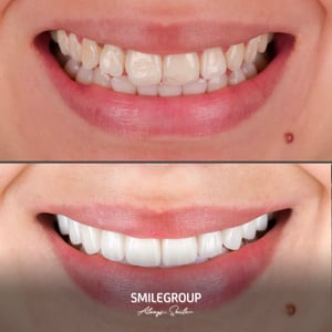 Smilegroup Ağız ve Diş Sağlığı Kliniği