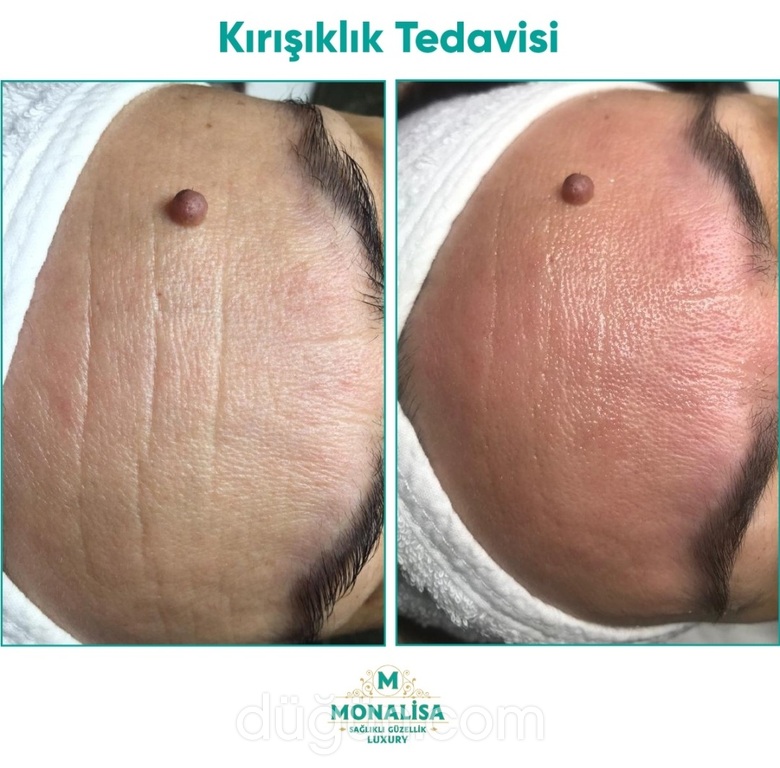 Monalisa Sağlıklı Güzellik Kliniği