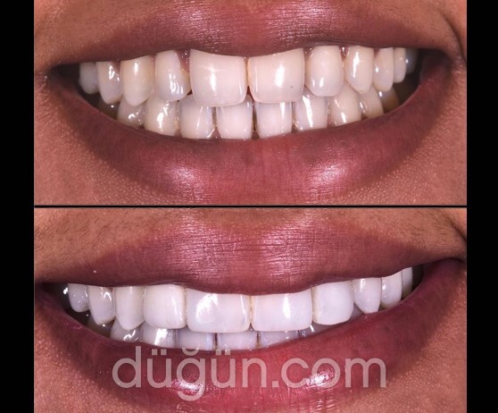 Uzmanlar Ağız ve Diş Sağlığı Kliniği