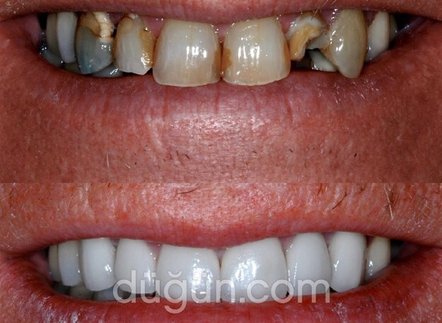 Uzmanlar Ağız ve Diş Sağlığı Kliniği