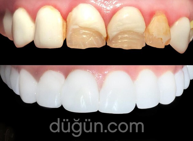 Uzmanlar Ağız ve Diş Sağlığı Kliniği